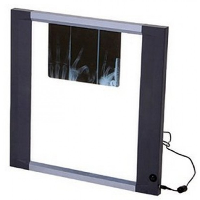 Негатоскоп Dixion X-View LED 1540